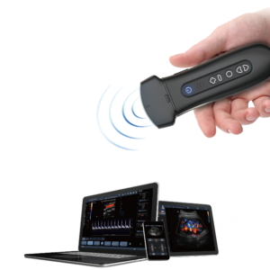 Youkey Soloscan P50
